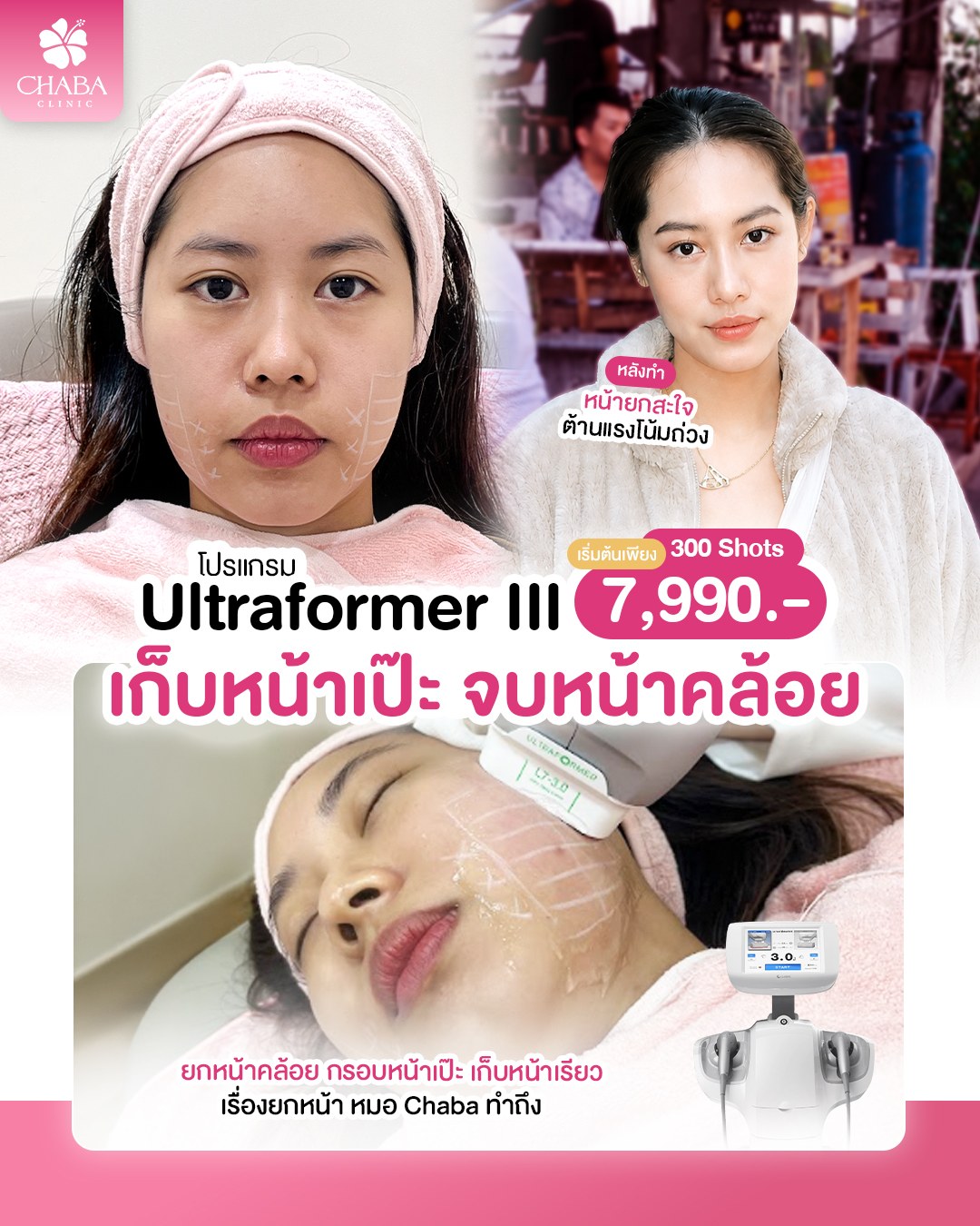 Chaba Clinic promotion